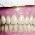 Жительнице Владимира поставили в частной клинике «средневековые» зубные протезы