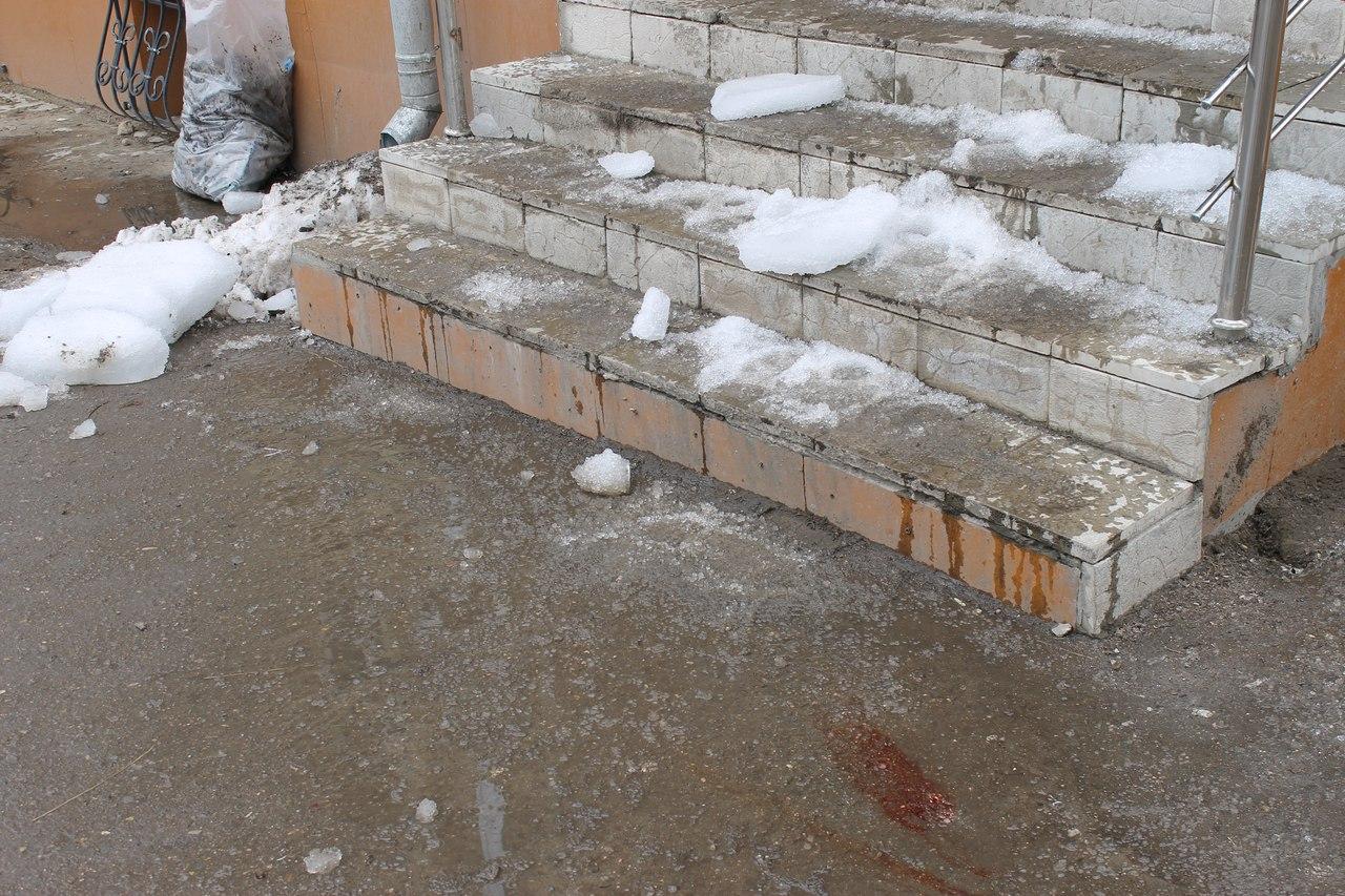 Очнулась – гипс. 58 000 рублей взыскала с ЖЭКа жительница Перми за неудачное падение Очнулась – гипс. 58 000 рублей взыскала с ЖЭКа жительница Перми за неудачное падение